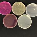 Different types of agar plates (left to right, upper row then lower row: Rose bengal chloramphenicol agar, potato dextrose agar, plate count agar with cetrimide, fucidin and cephaloridine supplementation, MacConkey agar and plate count agar) with colonies